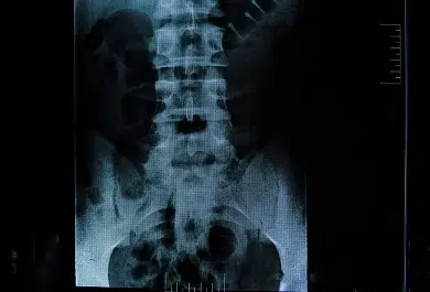 Man Shot By ICE Speaks Out, Says Bullet Is Still In Him
